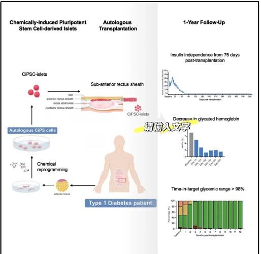 糖尿病治疗干细胞_细胞病糖尿治疗干预方案_干细胞治糖尿病费用