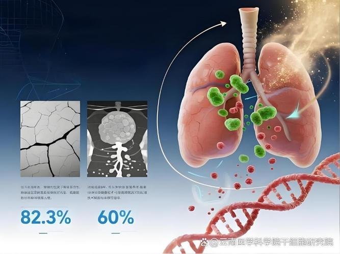 慢阻肺干细胞治疗_慢阻肺干细胞移植吧_干细胞可治愈慢阻肺吗