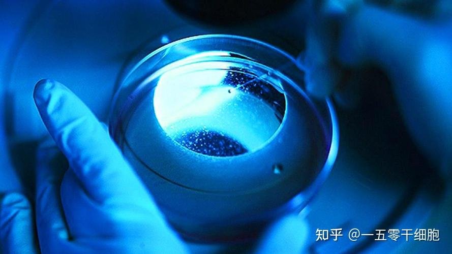 类风湿干细胞移植治疗贵吗_干细胞移植治疗类风湿多少钱_风湿干细胞移植多少钱