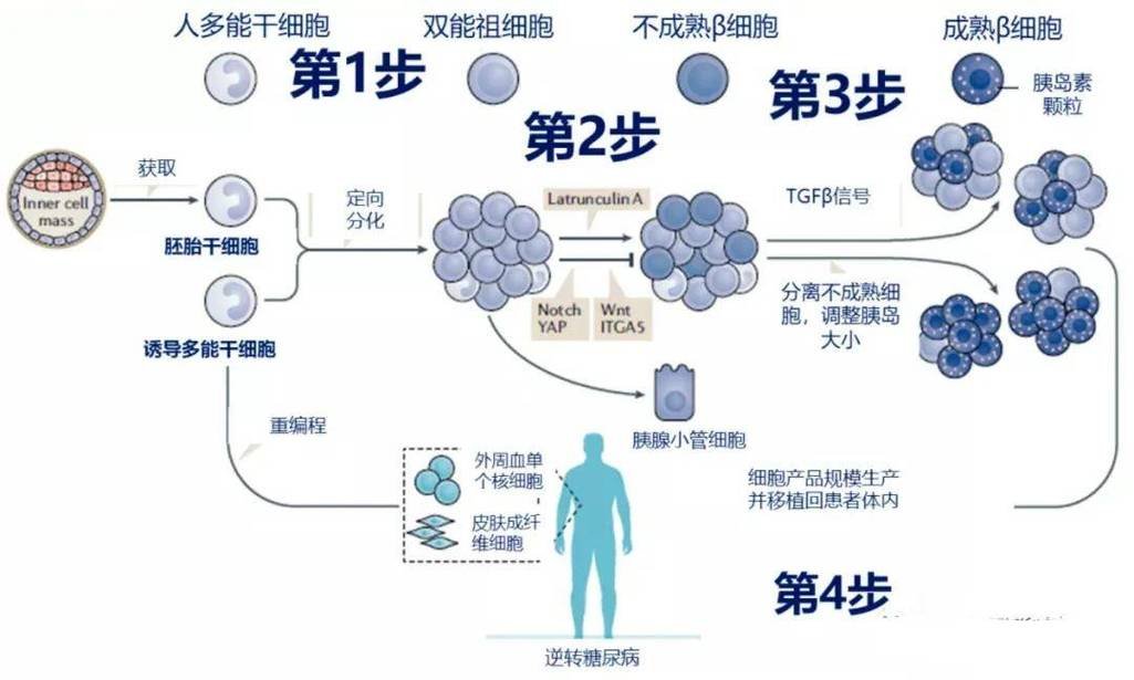 静脉注射干细胞治疗糖尿病_干细胞注射多少钱一支糖尿病_糖尿病打一针干细胞多少钱